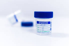FRASCO CITOQUIMICO (CEPILAB)